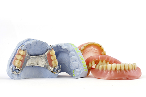 A group of removable partial dentures on a white background