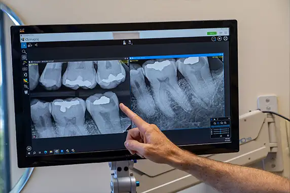 Digital x-rays on monitor.
