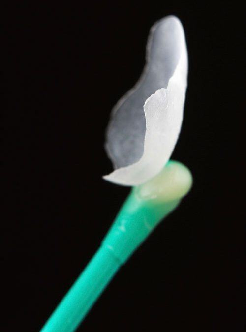 Ways of Keeping Veneers as Long as Possible