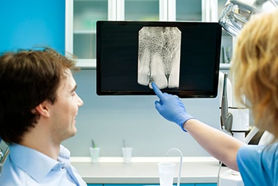 Why Dental X Rays Are Essential For Getting Proper Dental Care?