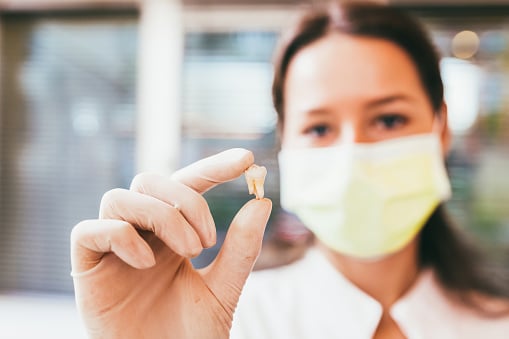 Can Missing Teeth Cause Wrinkles?