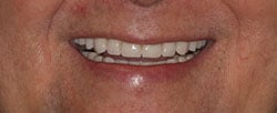 Case 1 after