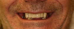 Case 2 before