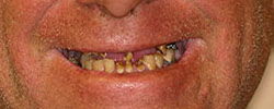 Case 4 before