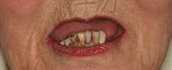 Case 5 before
