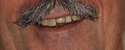 Case 7 before