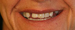 Case 9 before