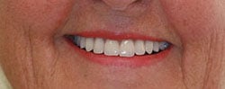 Case 10 after