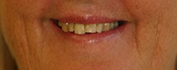 Case 10 before