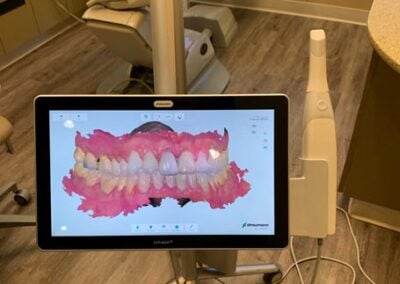 Intra oral scanner and computer screen display