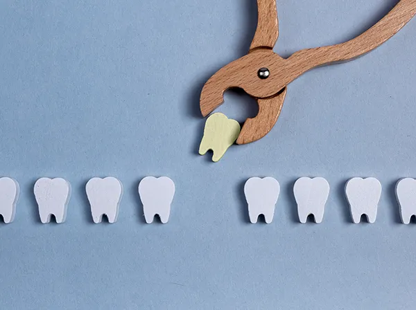 Row of wooden tooth shapes, one of which is being pulled out of the row by dental pliers at Dental Implant Center at Walnut Creek in Walnut Creek, CA