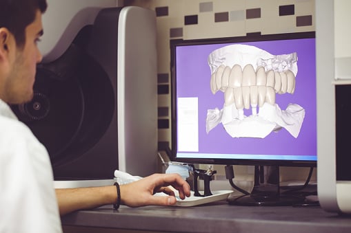 What is Dental Cone Beam CT?