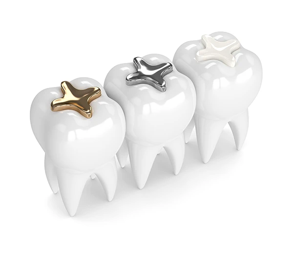 Tooth Cap vs Crown