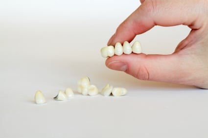 How Much of Your Tooth Do You Lose When You Get a Bridge?