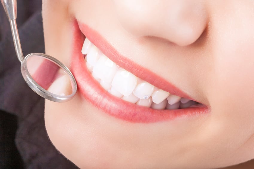 Do Sealants Protect Against Staining, Too?